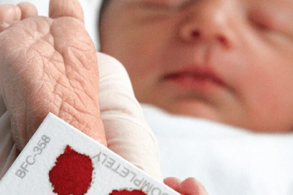 بیماری فنیل کتونوری وابسته به چیست؟